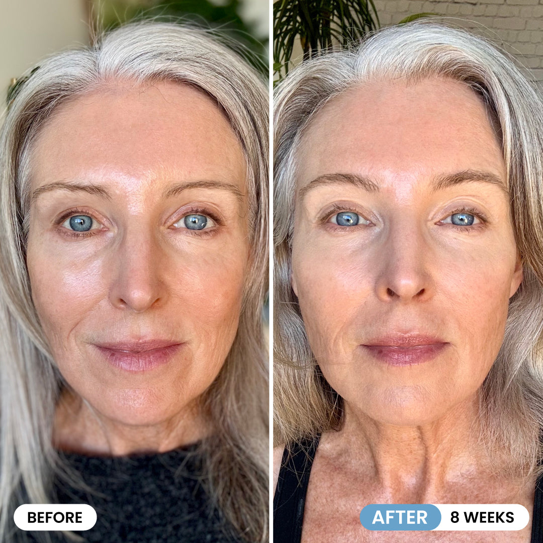 Side-by-side photos of a woman with gray hair, labeled Before and After 8 weeks. The After image shows smoother skin and a brighter complexion compared to the Before image.